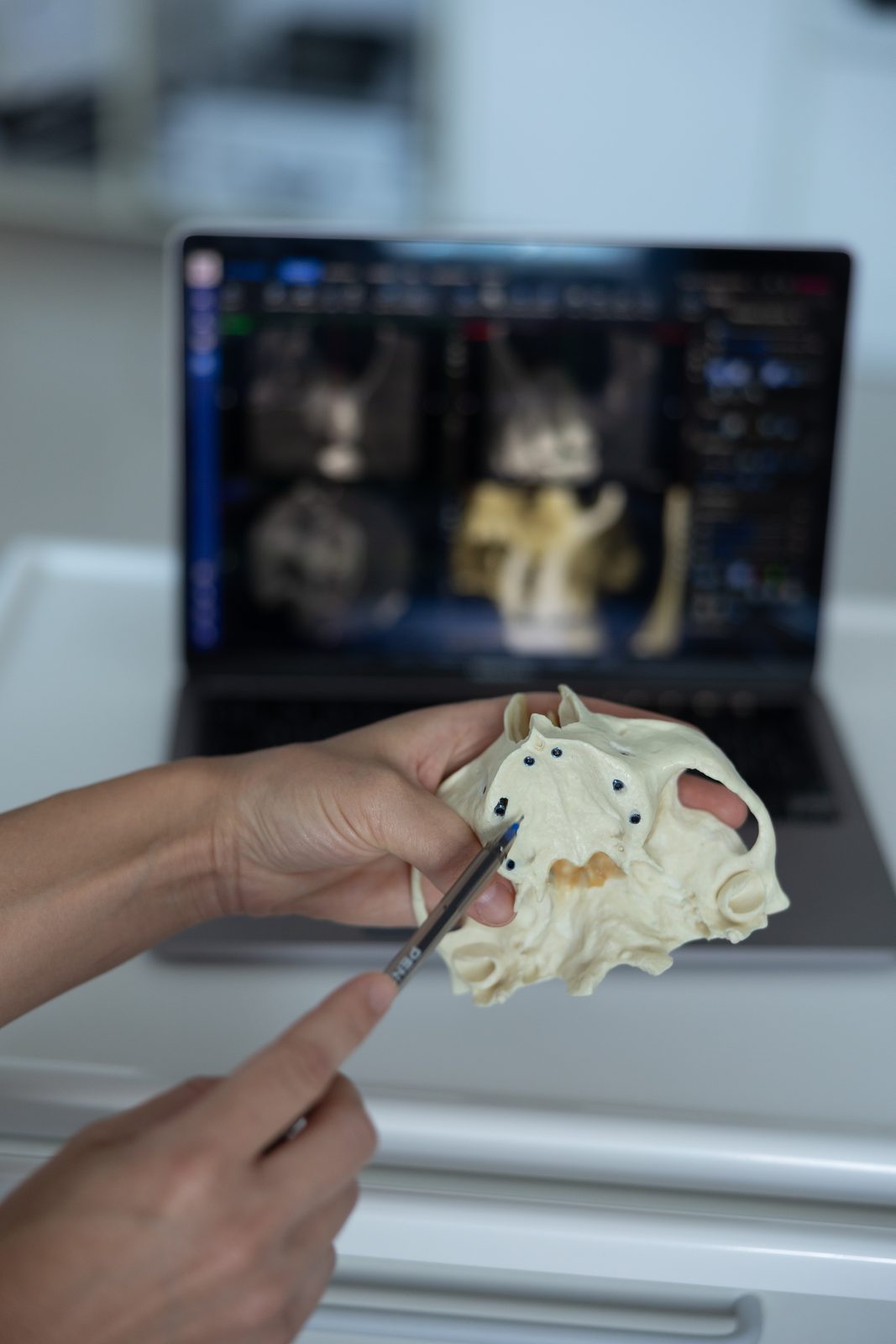 Lucrare de protetică dentară la clinica Dr Olga